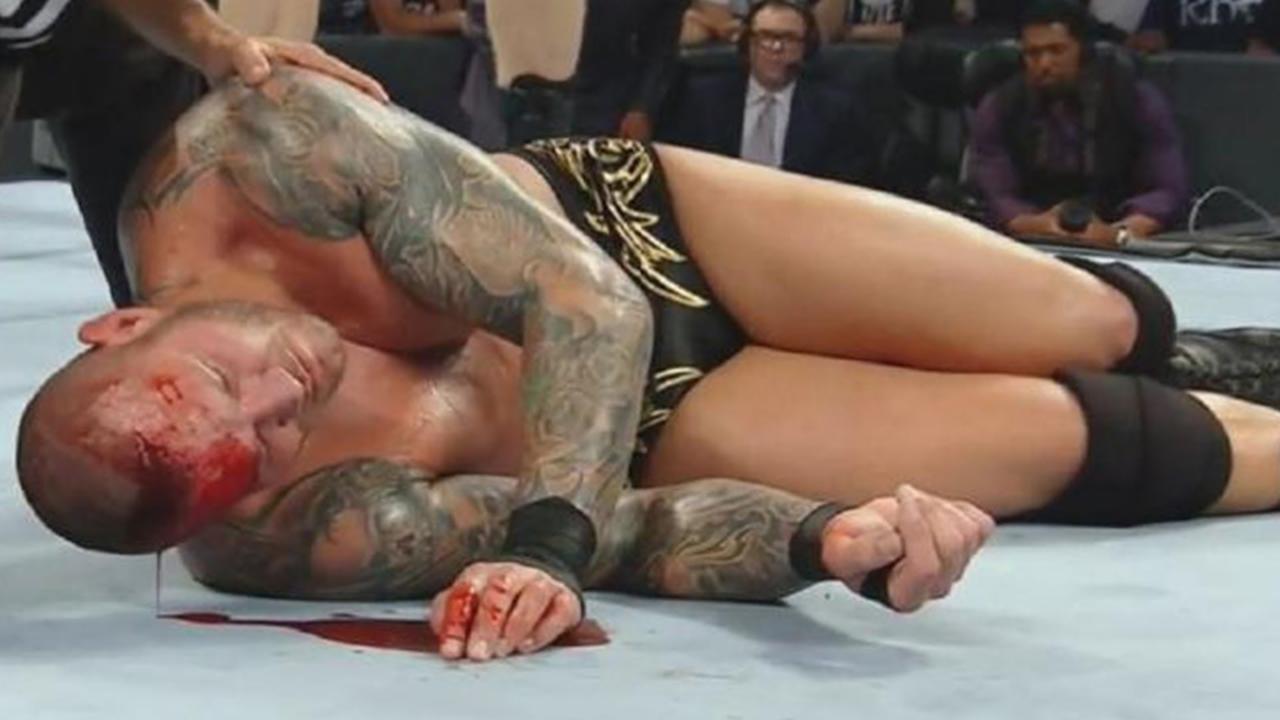 Randy Orton Bleeds From A Hard Way Elbow