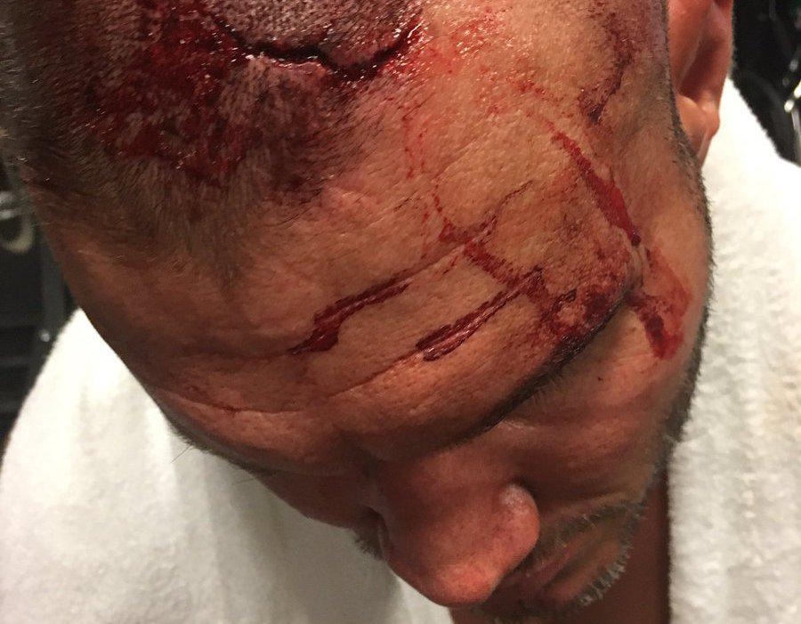 8. Brock Lesnar Splits Randy Orton's Head Open