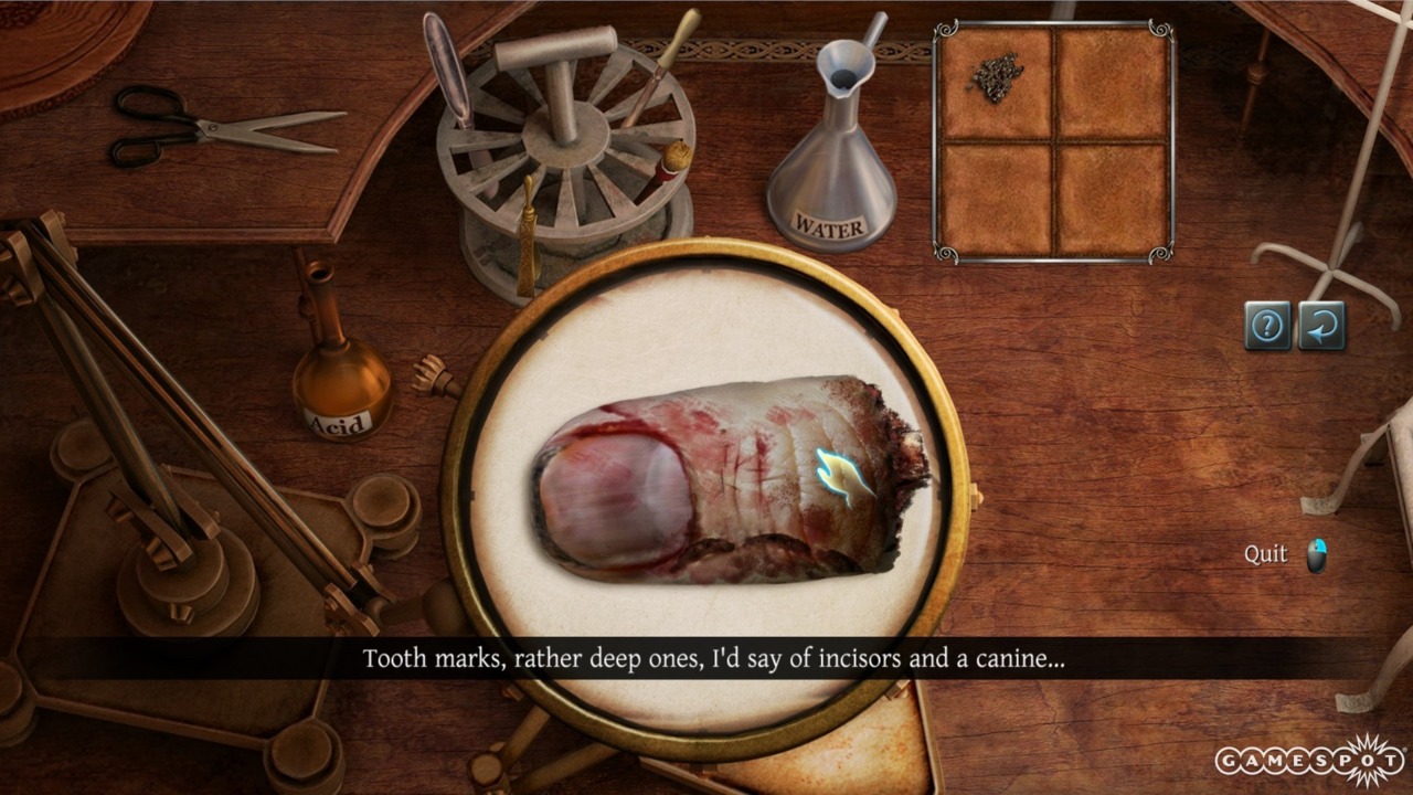 Testament is not for the faint of heart. One of the first clues you have to examine is this severed thumb.